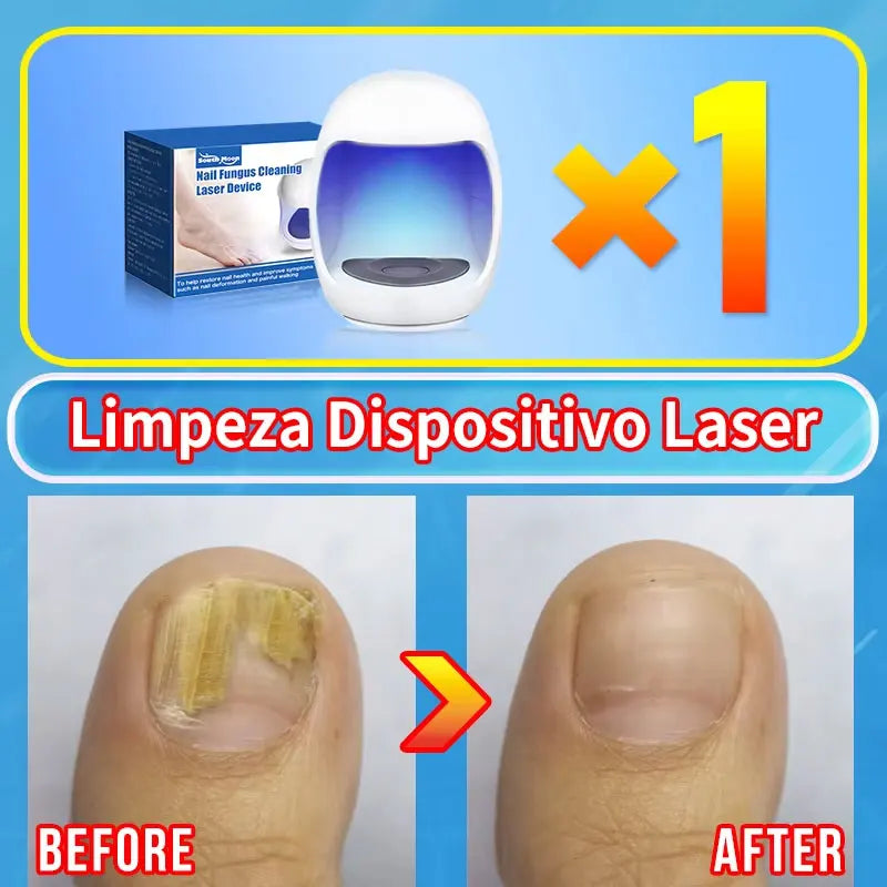 Technology changes lives,Rejuvenator - Fungus Prevention Technology - Adjustable Control & Safety Sensor