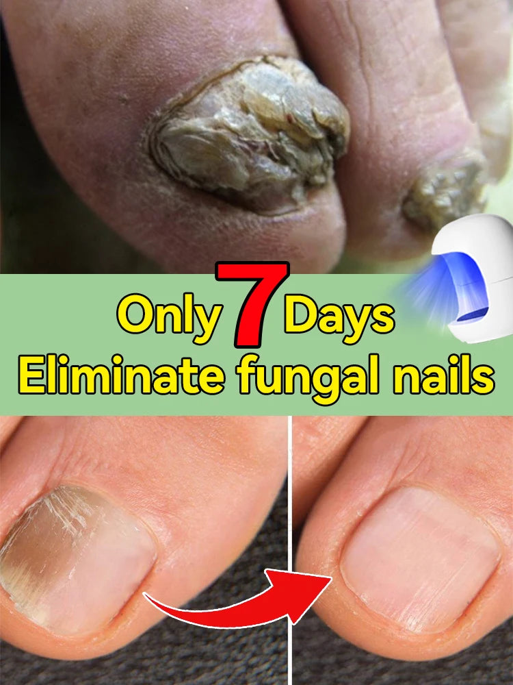 Technology changes lives,Rejuvenator - Fungus Prevention Technology - Adjustable Control & Safety Sensor