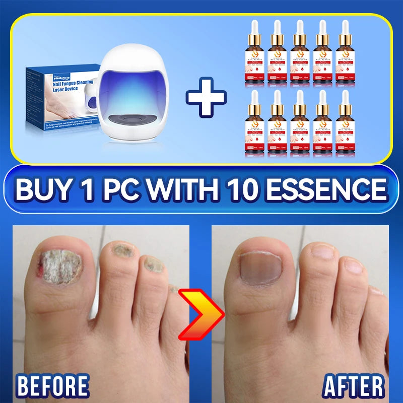 Technology changes lives,Rejuvenator - Fungus Prevention Technology - Adjustable Control & Safety Sensor