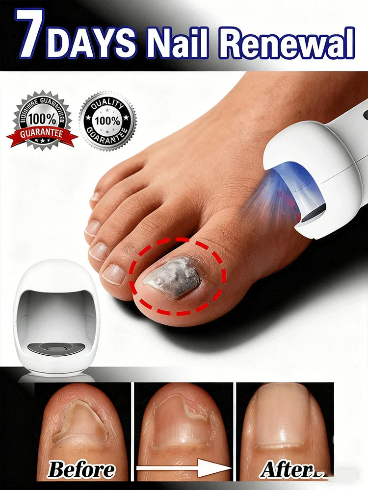 Technology changes lives,Rejuvenator - Fungus Prevention Technology - Adjustable Control & Safety Sensor