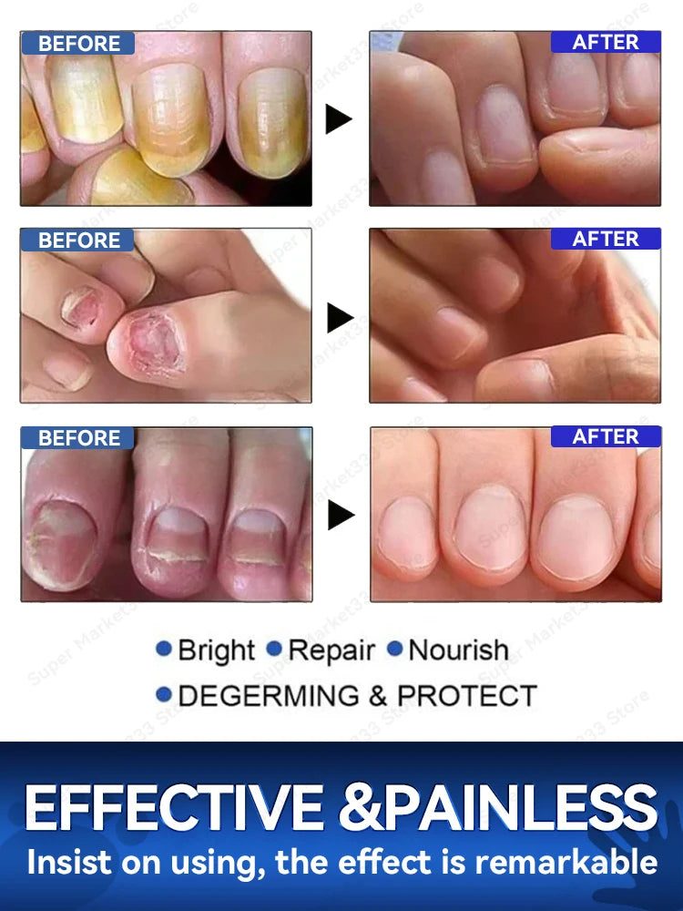 Technology changes lives,Rejuvenator - Fungus Prevention Technology - Adjustable Control & Safety Sensor