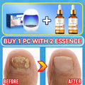 Technology changes lives,Rejuvenator - Fungus Prevention Technology - Adjustable Control & Safety Sensor