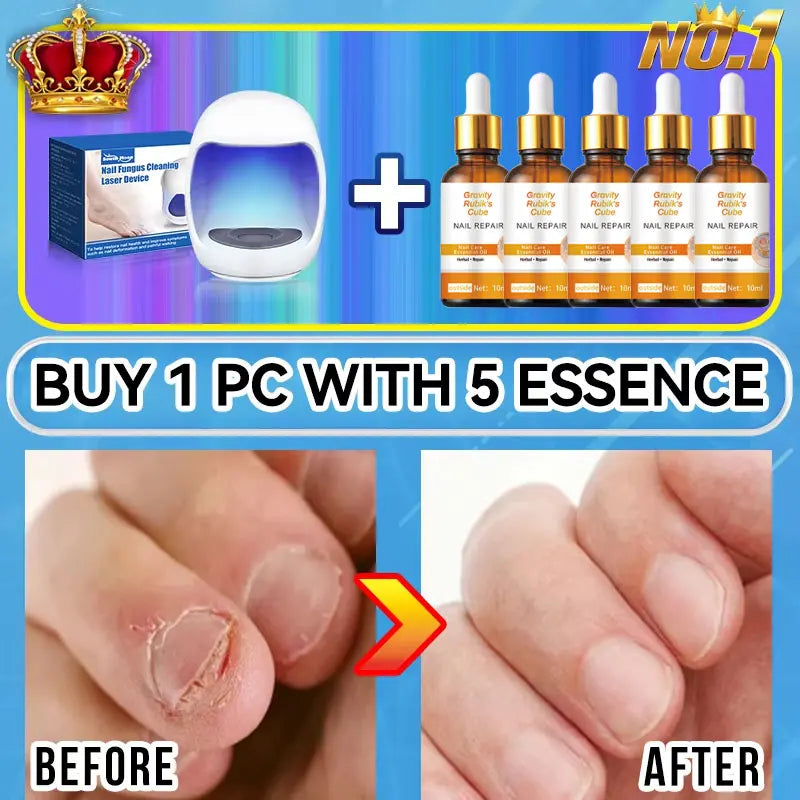 Technology changes lives,Rejuvenator - Fungus Prevention Technology - Adjustable Control & Safety Sensor