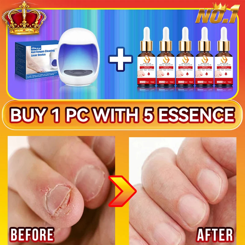 Technology changes lives,Rejuvenator - Fungus Prevention Technology - Adjustable Control & Safety Sensor
